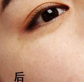 美容院祛斑产品，重塑肌肤光彩的艺术
