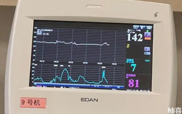 气压胎监设置，确保胎儿健康的关键步骤