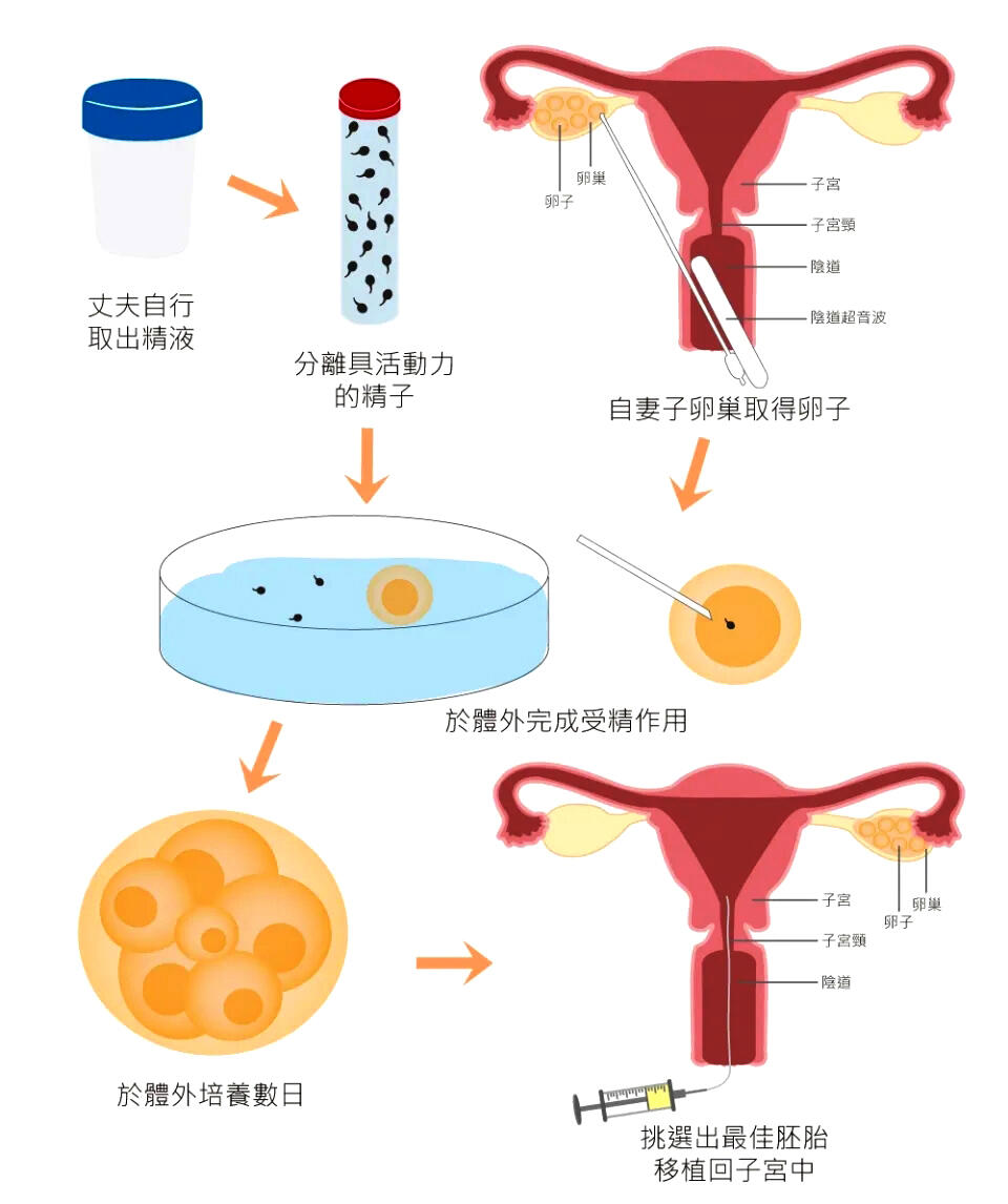 取卵后培育过程，生命的奇迹之旅