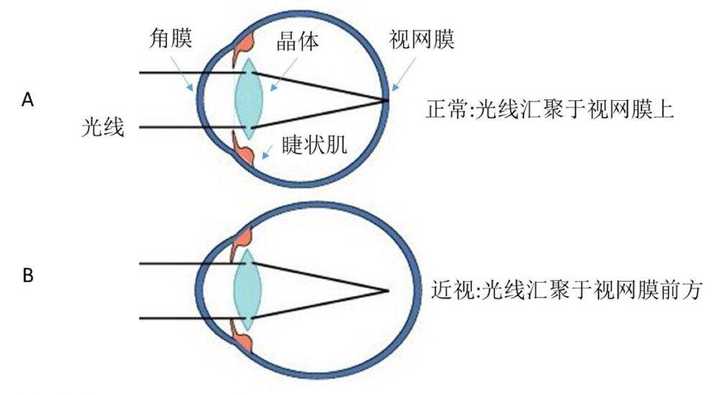 宝视达能查真假性近视吗，探究近视检测的新技术
