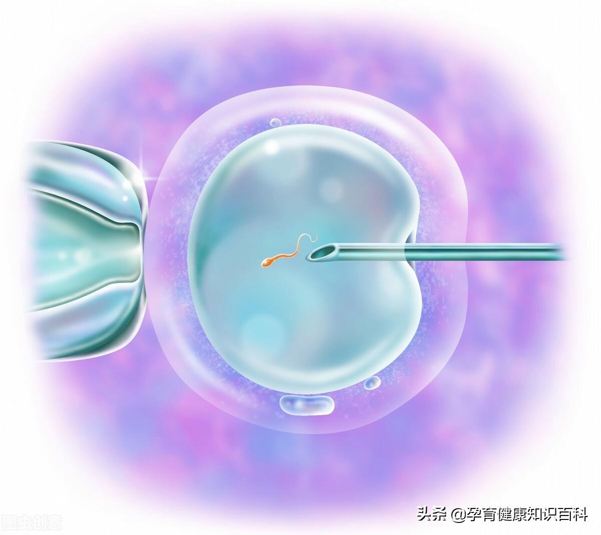 关于取卵过程中精子不可用及穿刺技术的应用