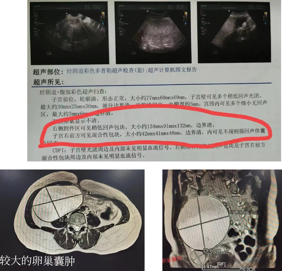 取卵手术，时间与过程解析