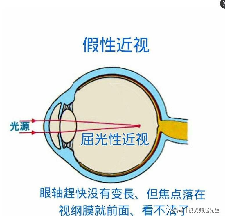 变色蔡司镜片真假识别指南