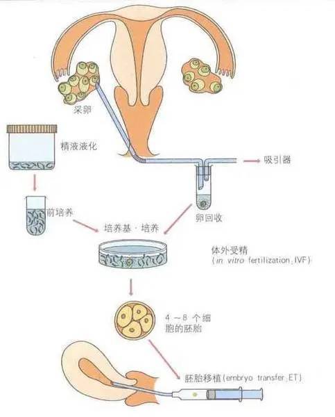 试管取卵当月能否移植，全面解析与指导