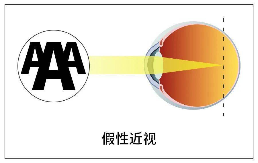 如何判断镜片真假，全面解析与实用指南